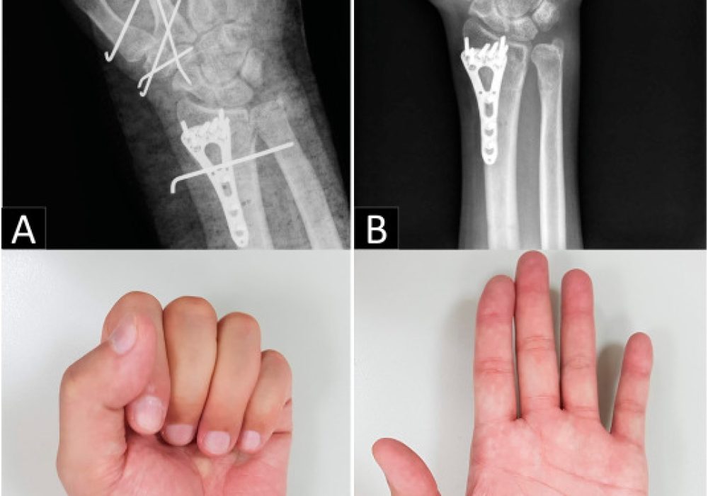 1-s2.0-S235264402100008X-gr2