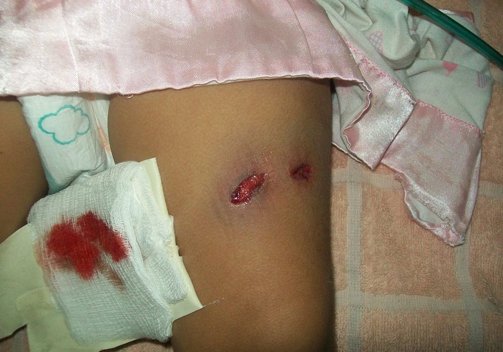 Trauma and Injury