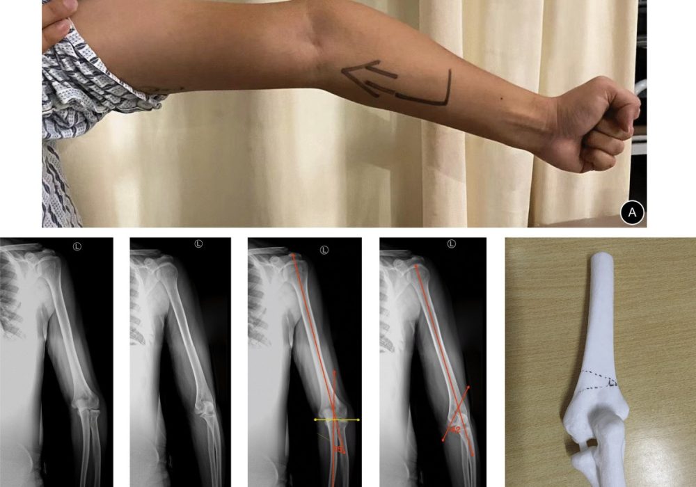 13018_2023_3939_Fig4_HTML