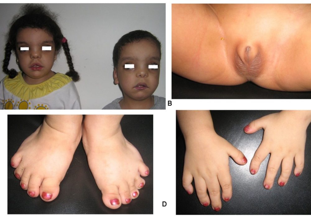 13023_2008_Article_115_Fig4_HTML