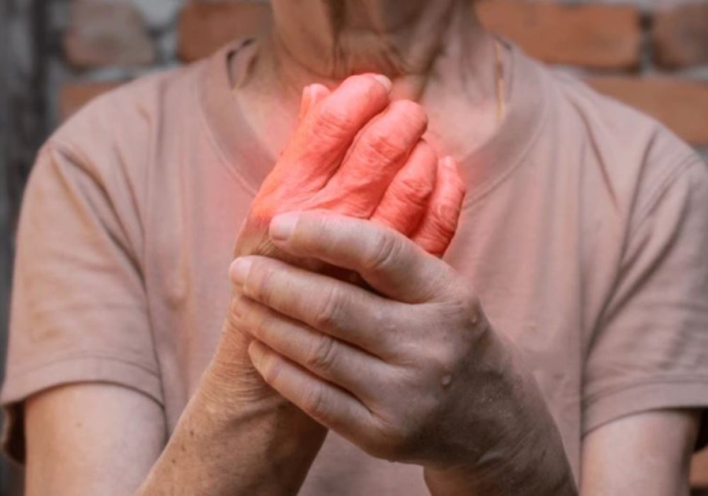 5 Swelling of finger & Hand