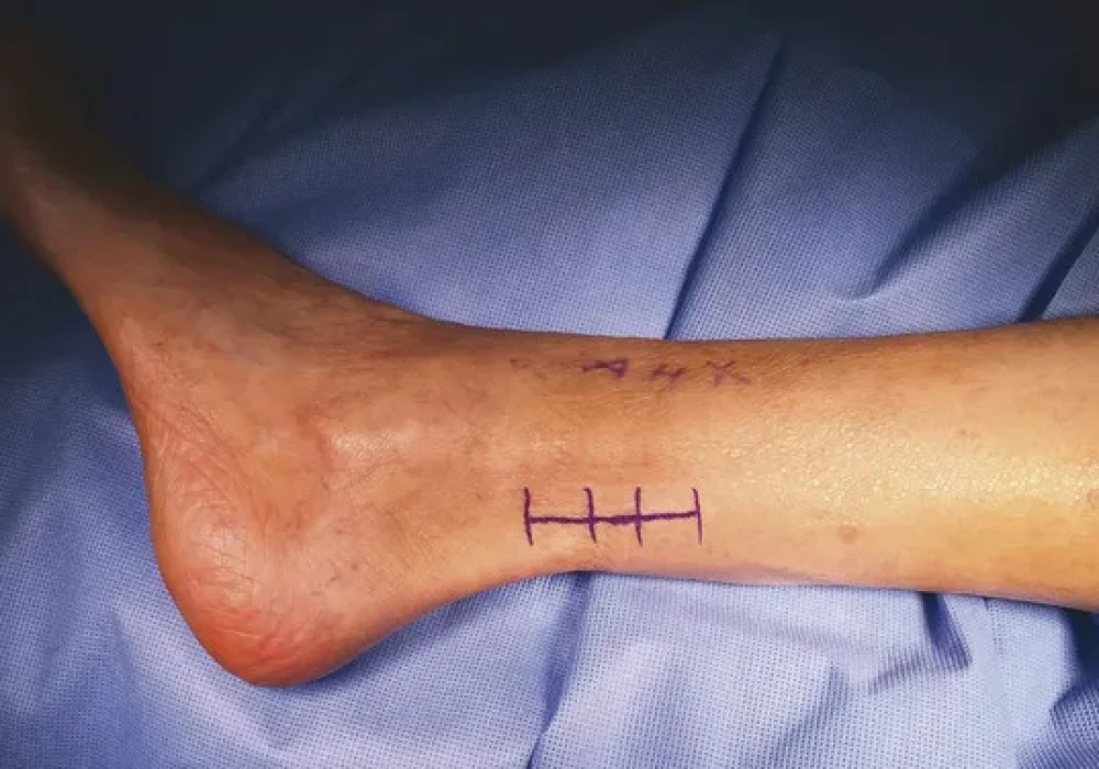 978-1-60406-899-3_c074_f001.tif_epub1