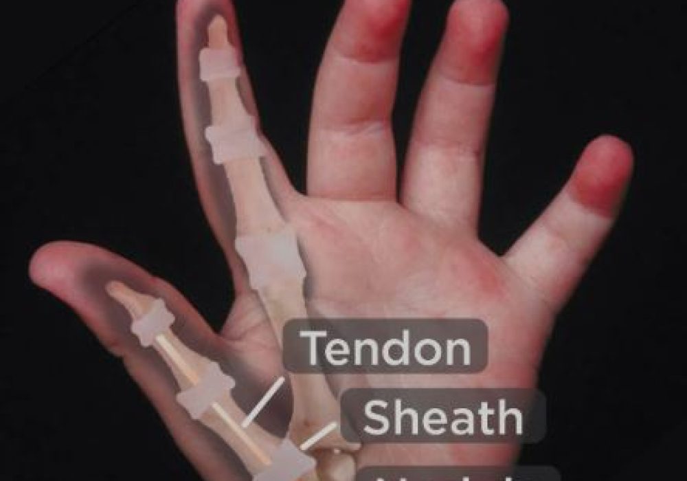 A1 Pulley Release Thumb