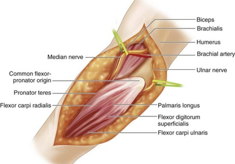 B9781455740246000216_f021-001-9781455740246