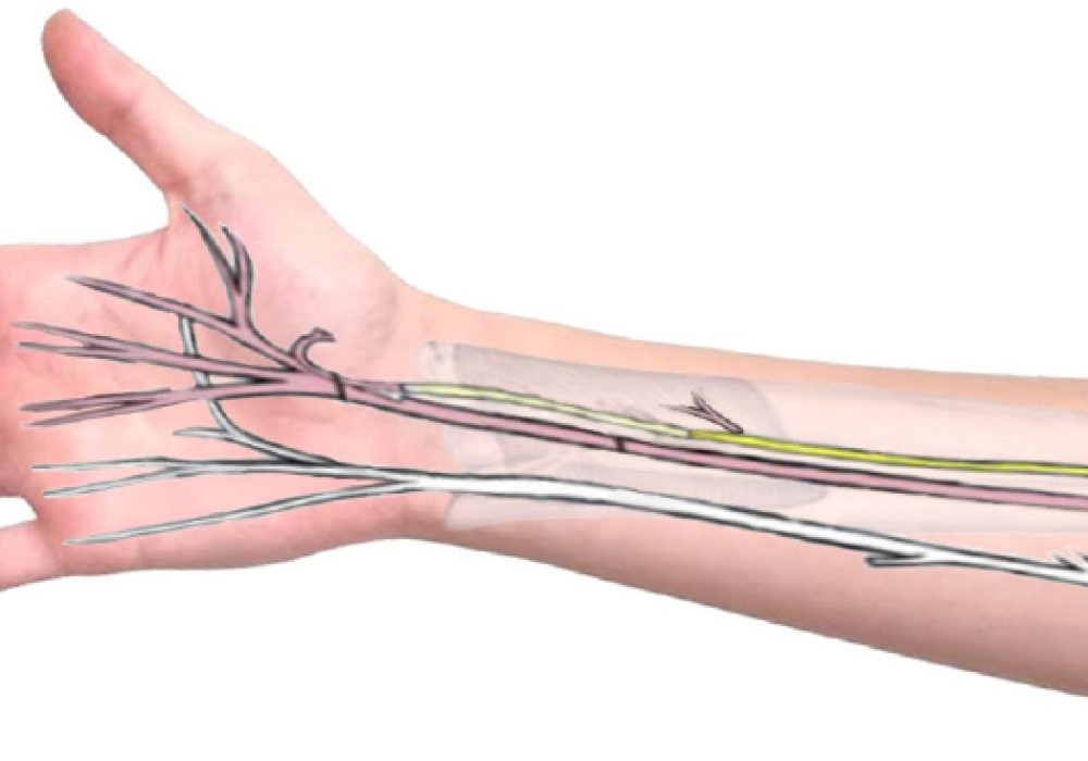 Distal nerve transfers