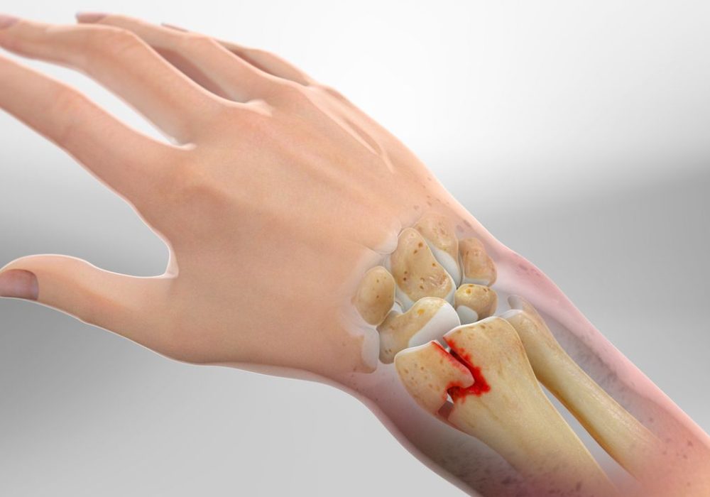 Fractures and Dislocations in Hand