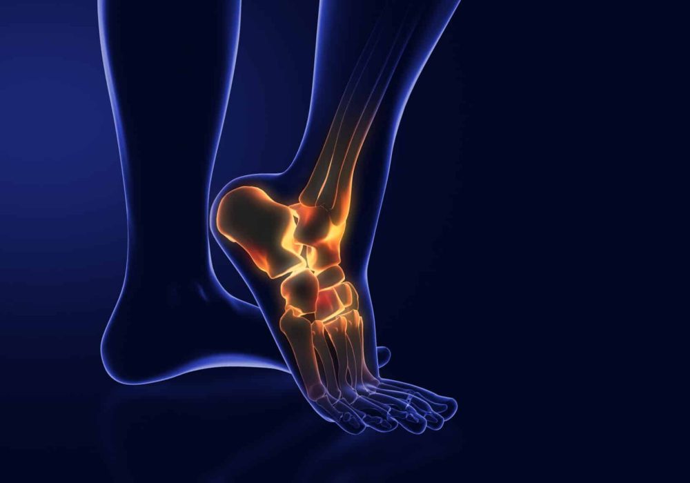 Medical animation for ankle pain
