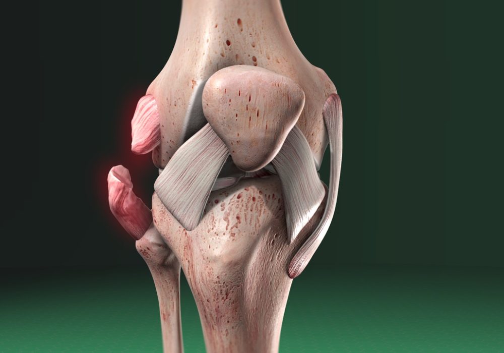 Ligament Repair & Reconstruction