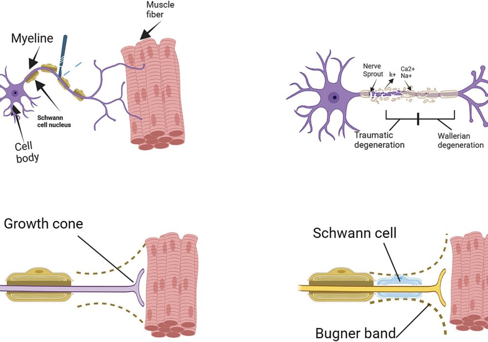 Microsurgery for Nerve Repair