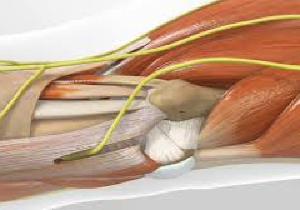 Nerve Decompression Surgeries