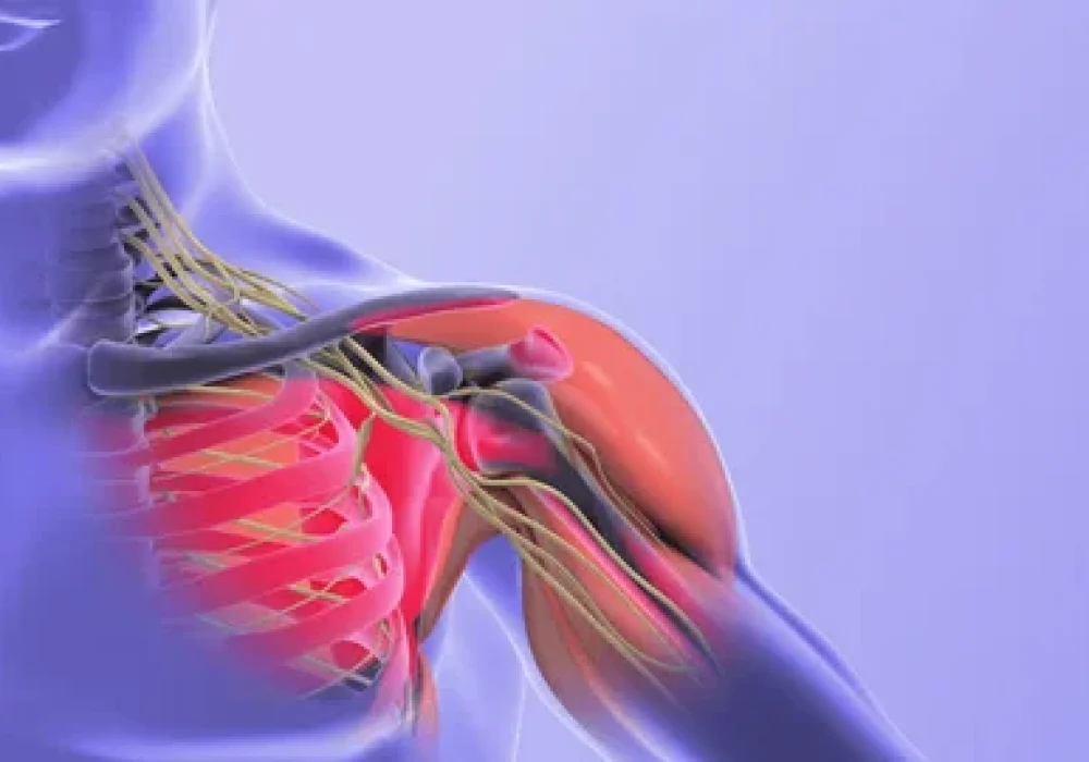 Pediatric Nerve Grafting