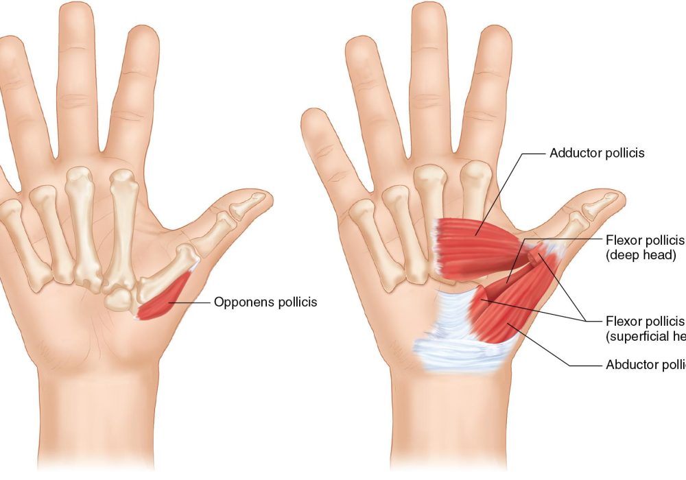 Pediatric Tendon Transfers