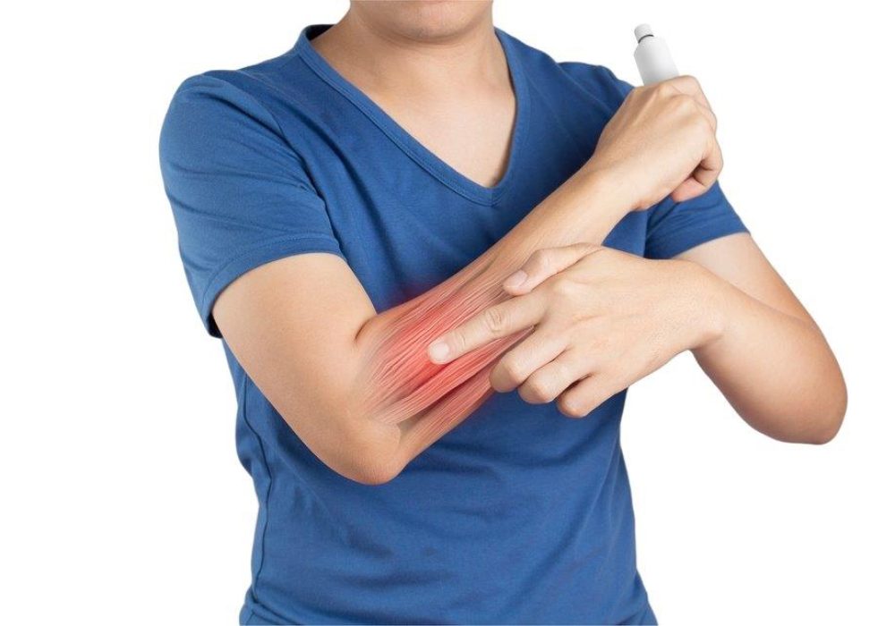 Radial Tunnel Syndrome