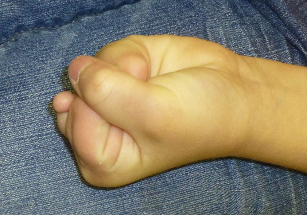 Toe to Thumb Transfer