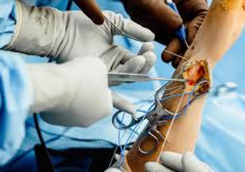 Wrist Arthroscopy
