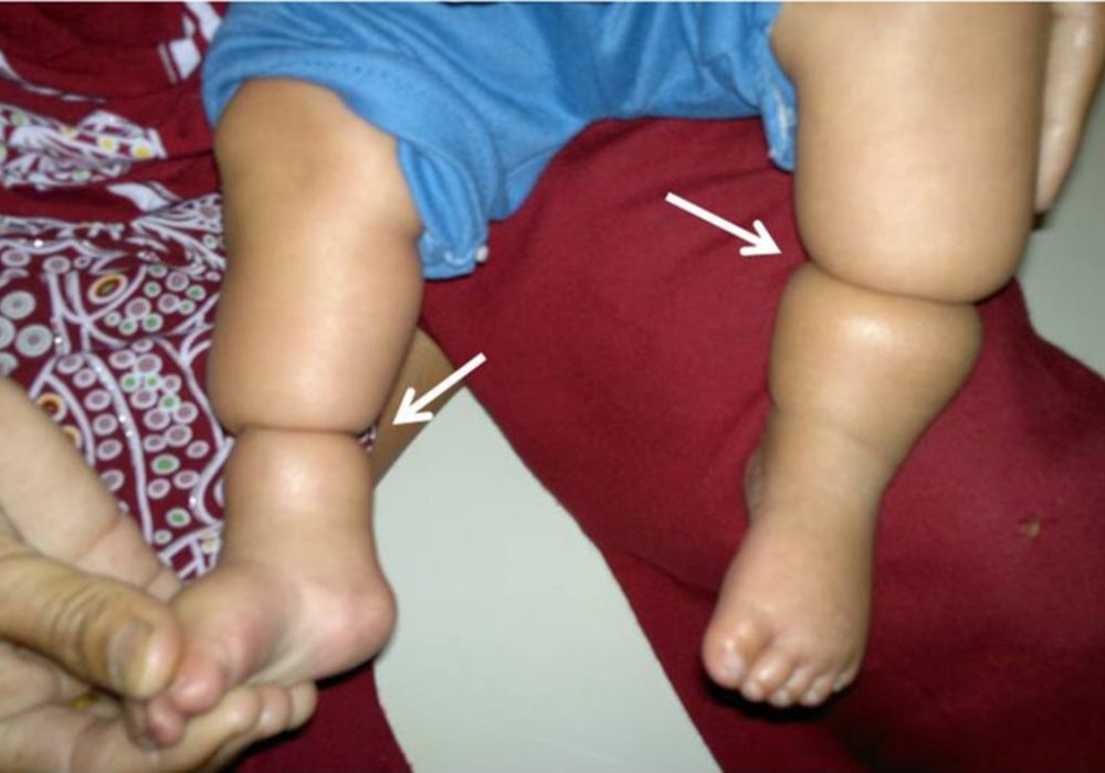 casereports-2015-April-2015---F1.large