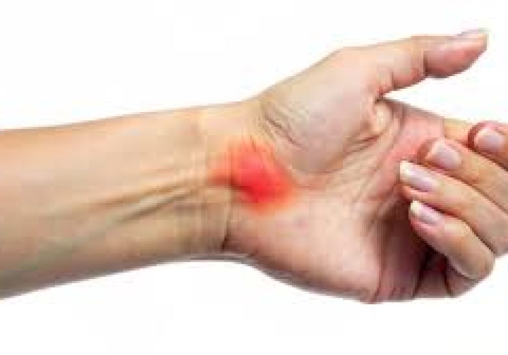 Removal of Swellings of Hand